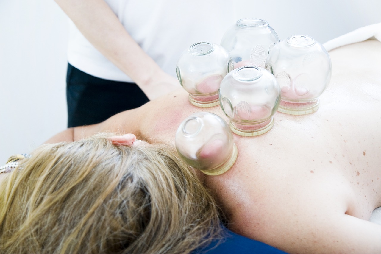 Myofascial Cupping (Negative Pressure Therapy)